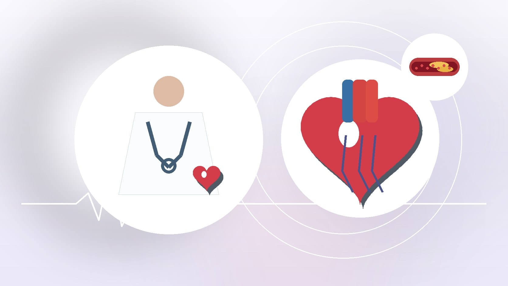 2018 American Heart Health Focus: Heart Disease in Younger Adults