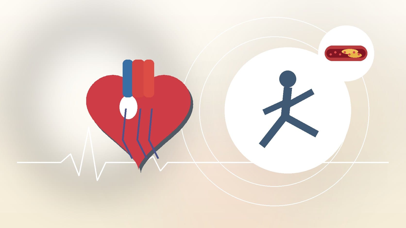 Angina Symptoms in Women: What You Might Not Expect | Cardiovascular Group