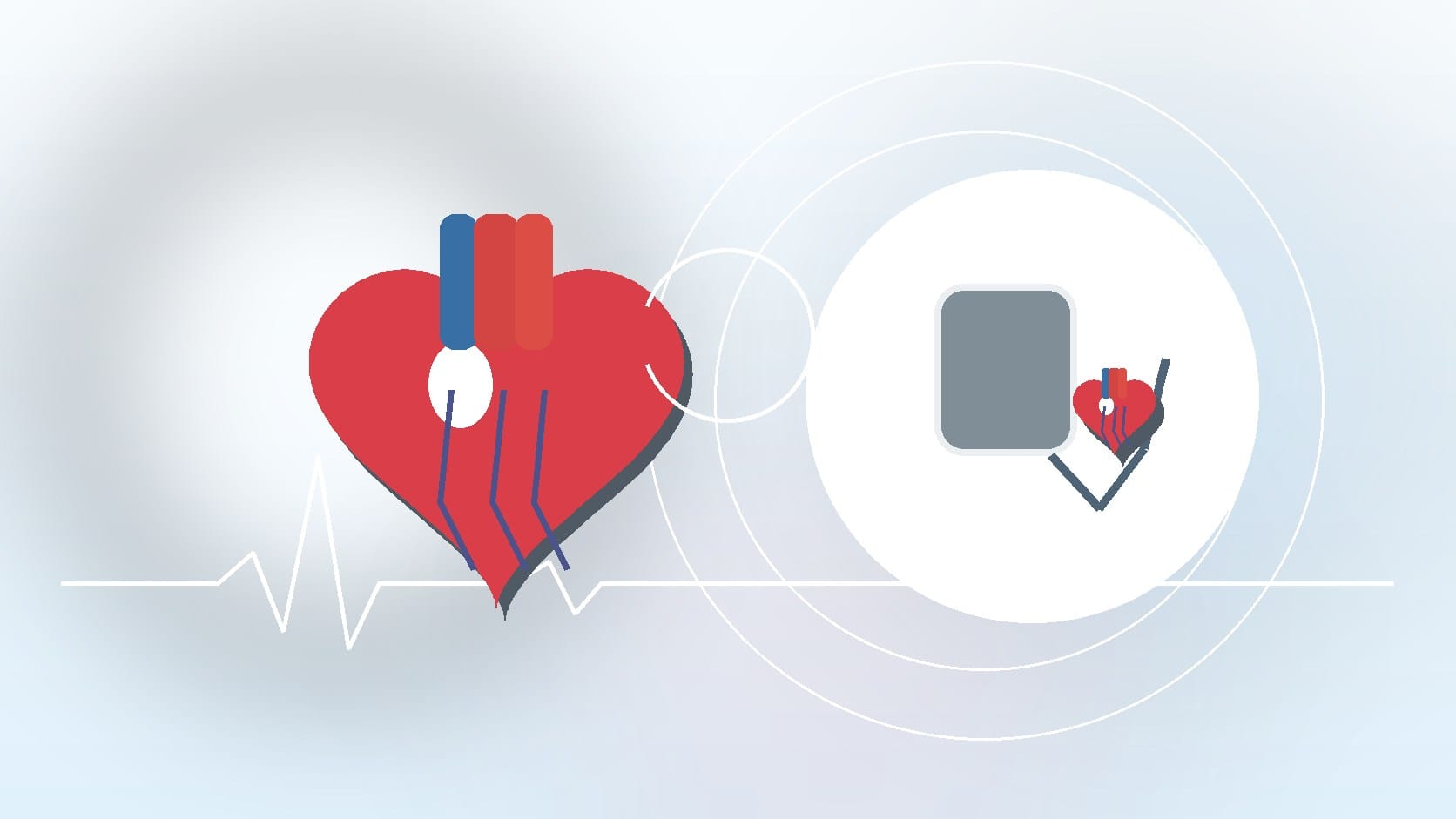 Are Athletes at an Increased Risk of AFib?