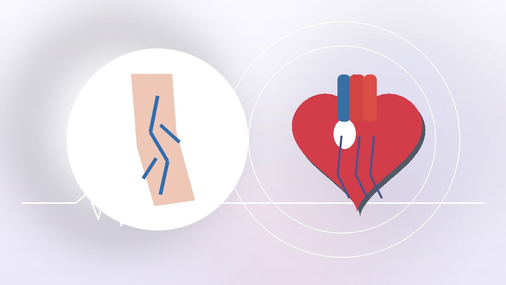 Are Varicose Veins Dangerous?