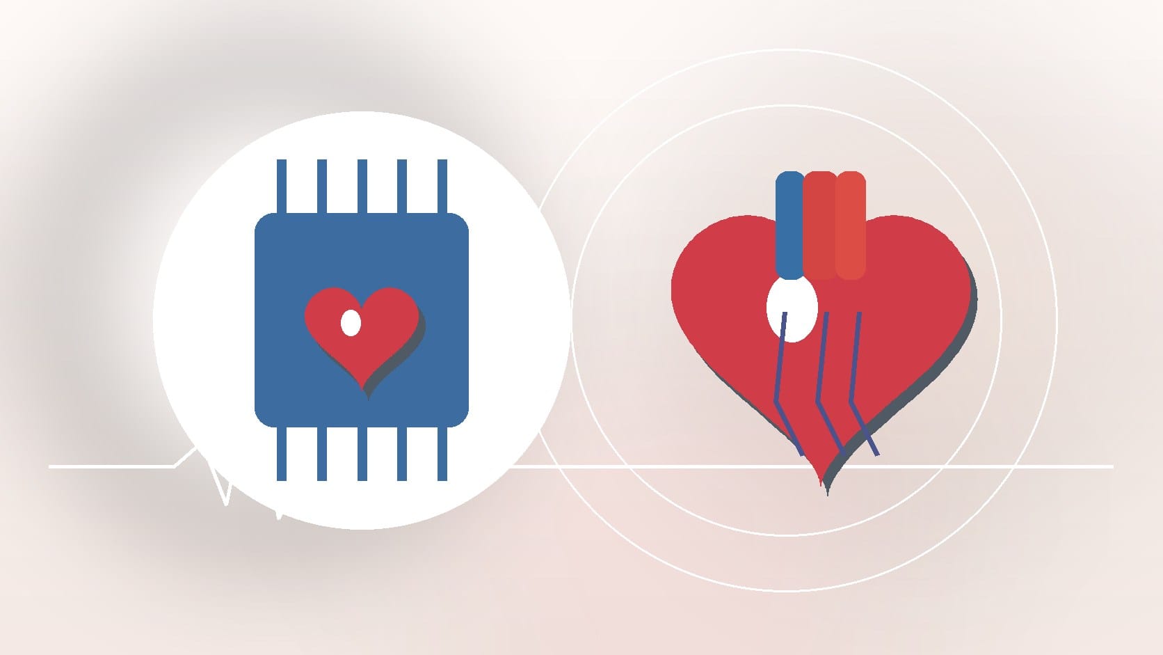 Artificial Intelligence in Cardiology: A New Frontier
