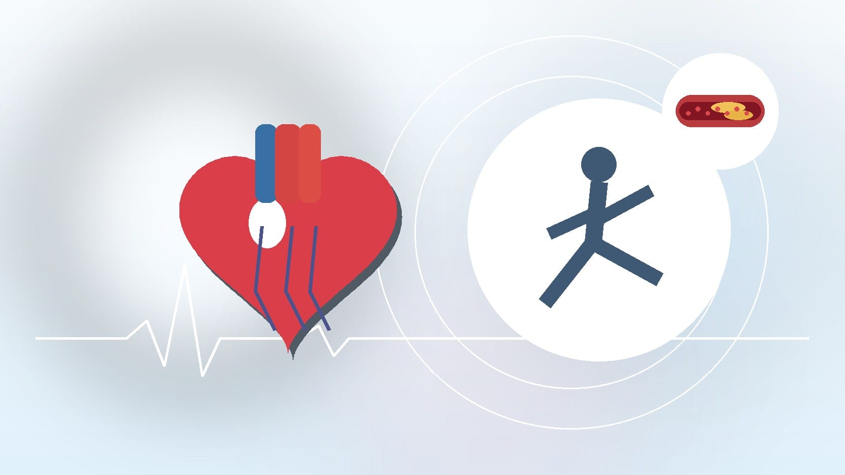 Atherosclerosis Treatments: Lifestyle, Medications, and More by Cardiovascular Group