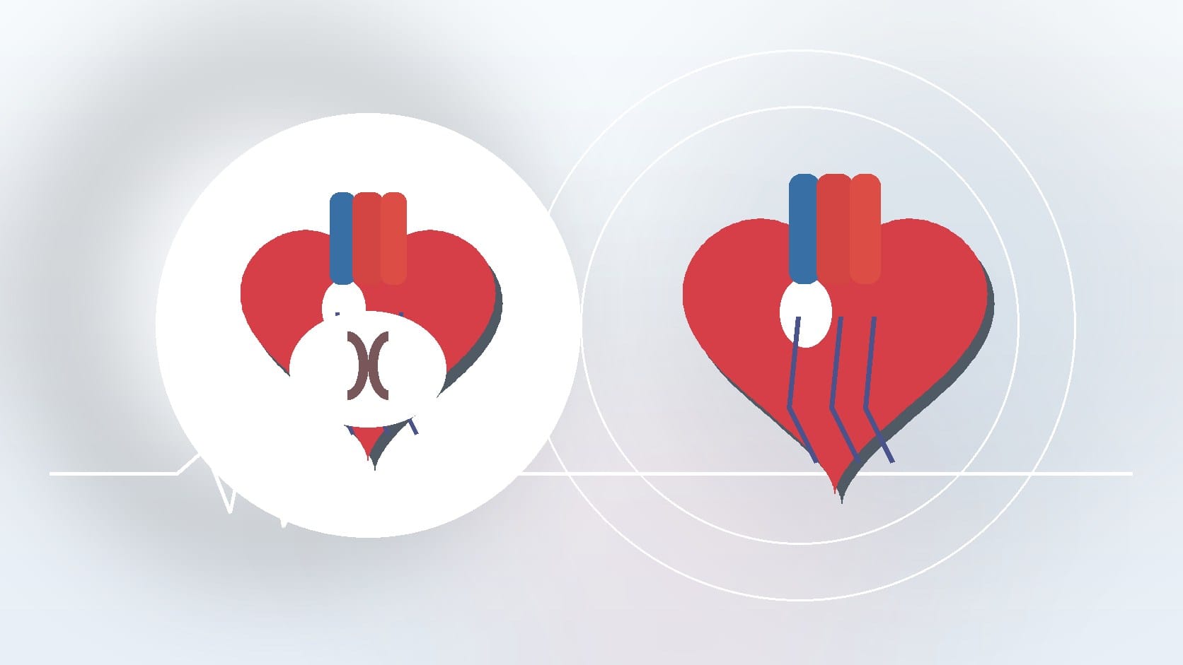 Benign Heart Murmurs: Causes and When to Seek Care Explained