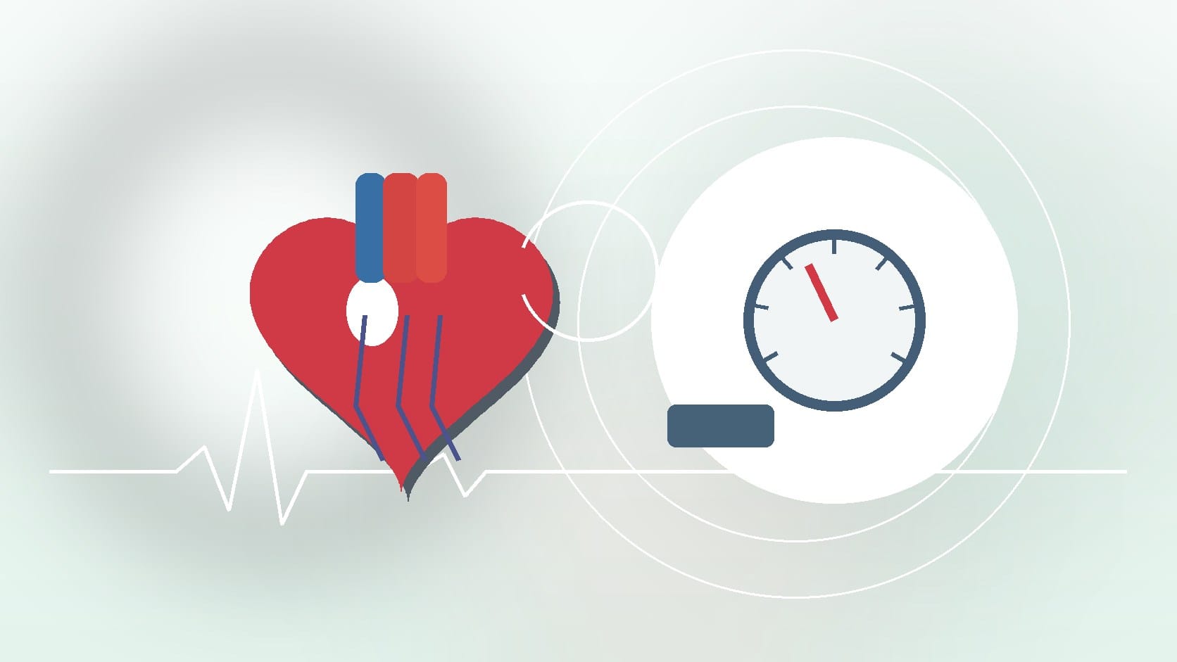 Can Hypertension Cause an Enlarged Heart? Understanding the Risks