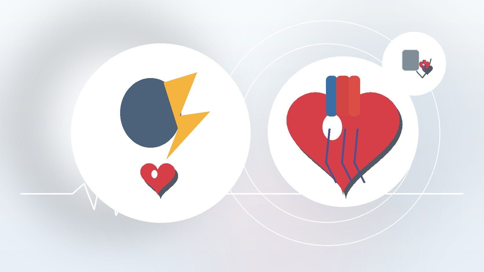 Can You Do a Stress Test in AFib? What to Know