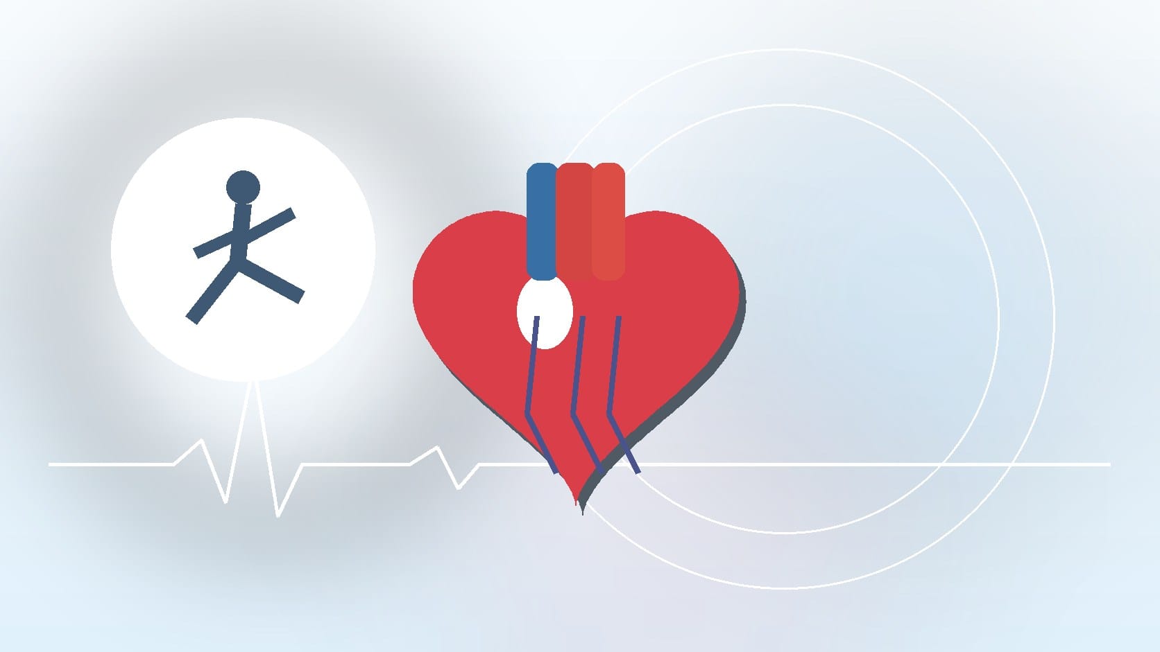 CVG Insights: What is an Electrocardiogram Test?