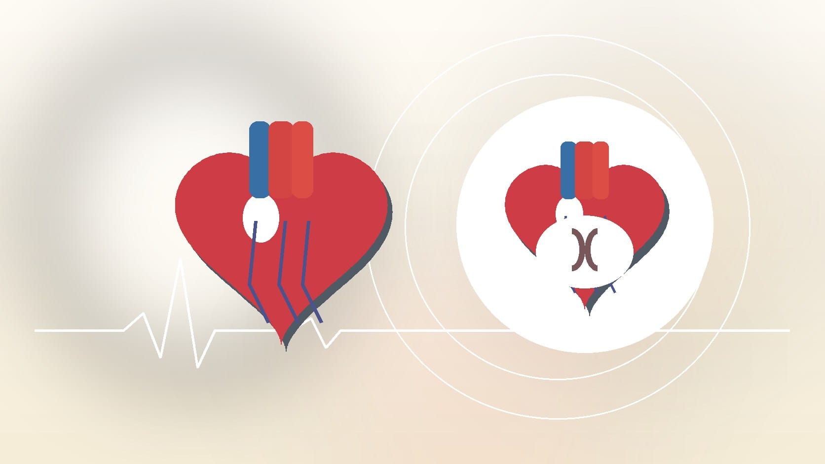 Do Heart Murmurs Go Away on Their Own?