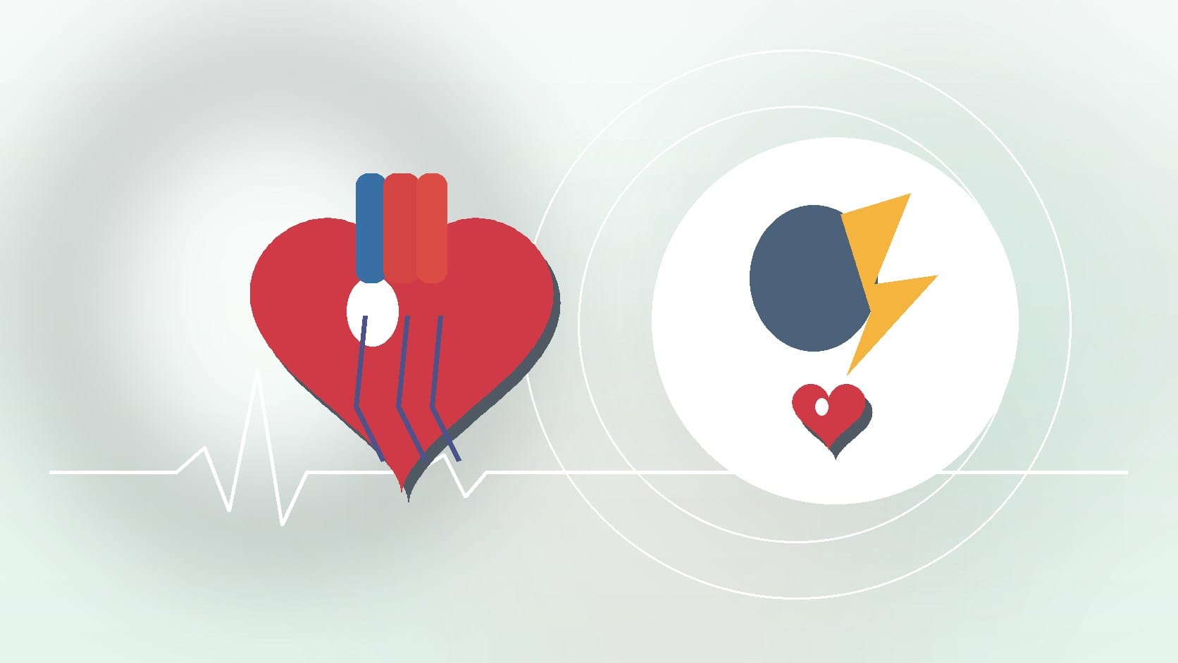 Does Cardiac Electrophysiology Involve Stress Tests?