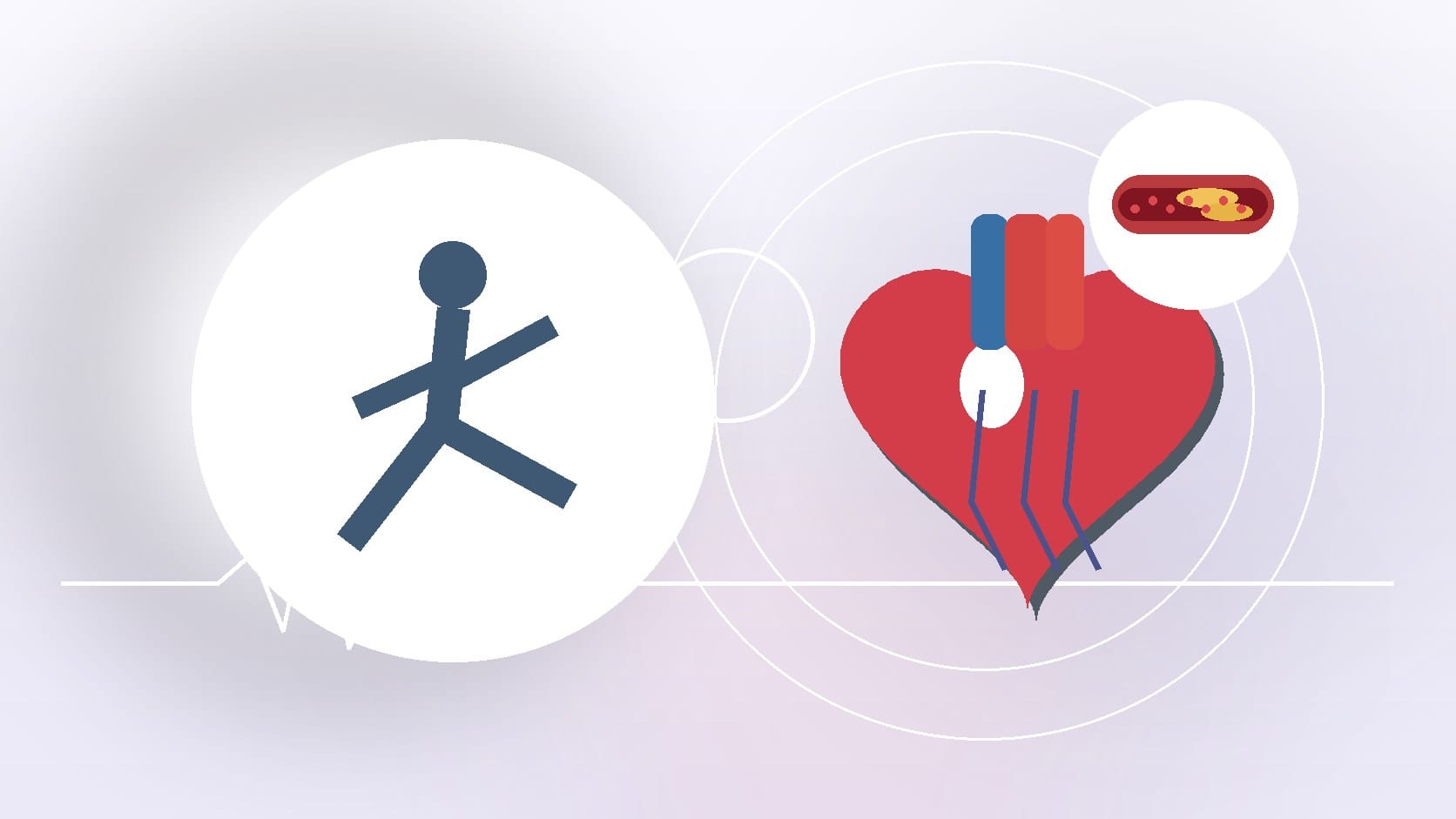 Does Football Increase Risk of Cardiovascular Disease?