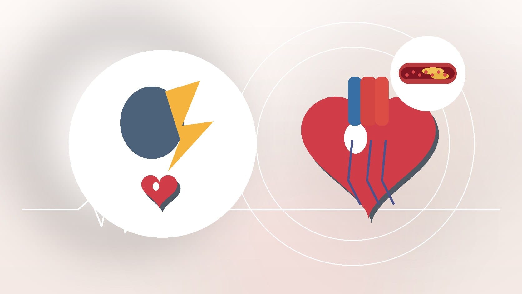 Guard Your Heart: Addressing The Relationship Between Anxiety and Heart Disease