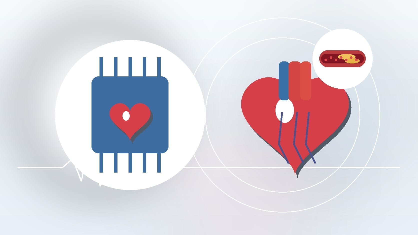 How AI Can Help Predict Heart Disease