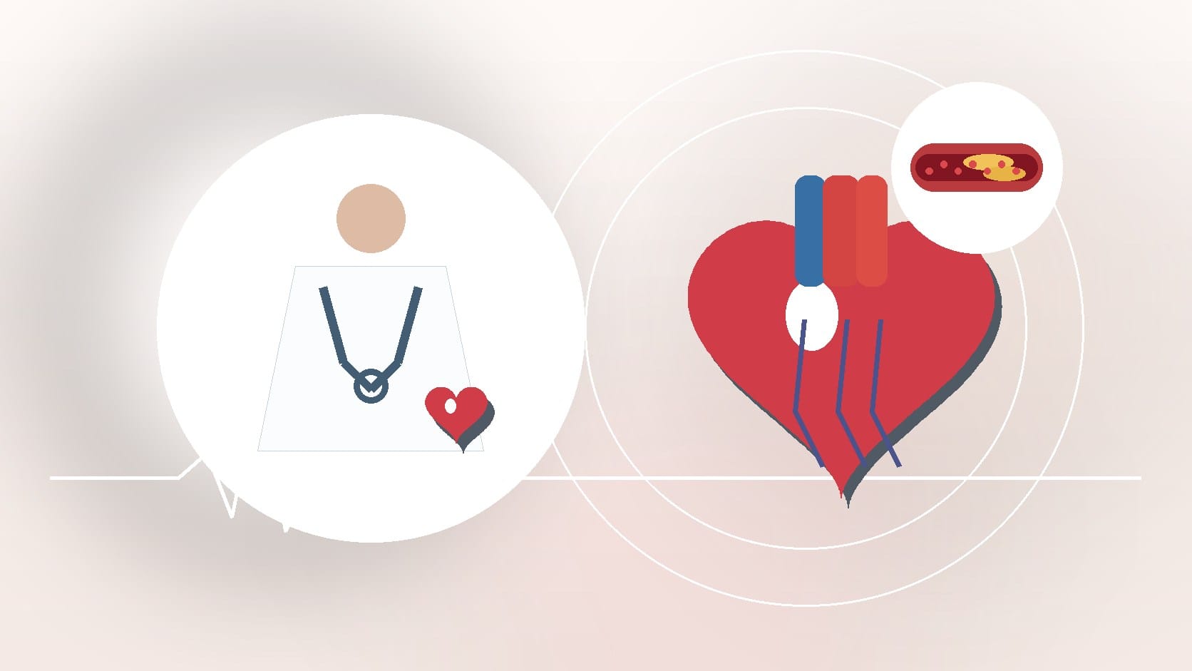 How Alzheimer’s Disease Can Affect Heart Health