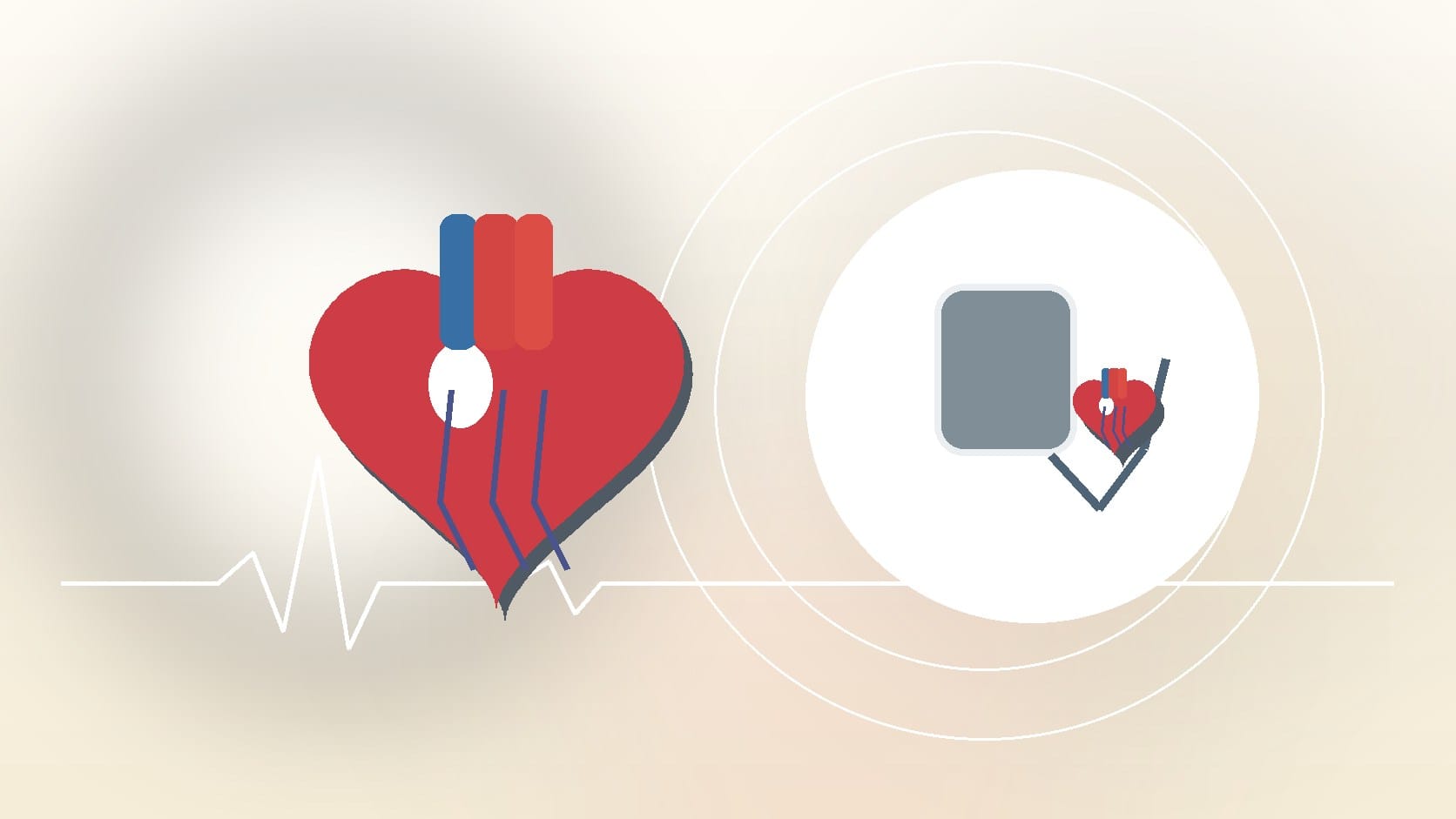 How an ECG Detects Tachycardia: What to Expect During the Test