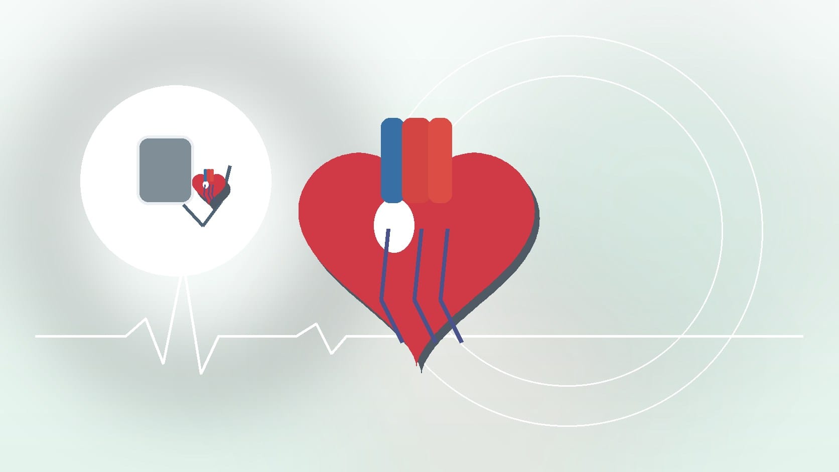 How an EKG Detects Irregular Rhythms and Why It Matters