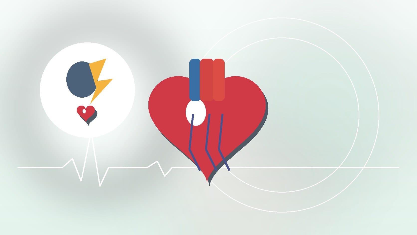 How Anxiety Can Cause Heart Flutters