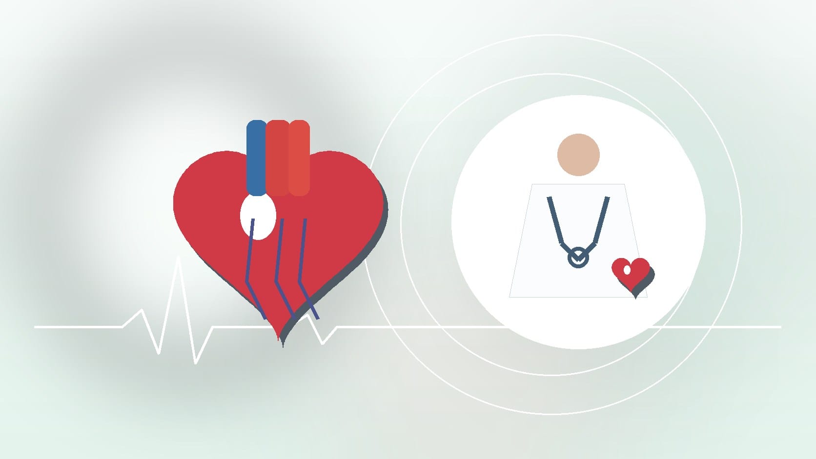 How Are Heart Conditions Diagnosed? Tests You Can Expect