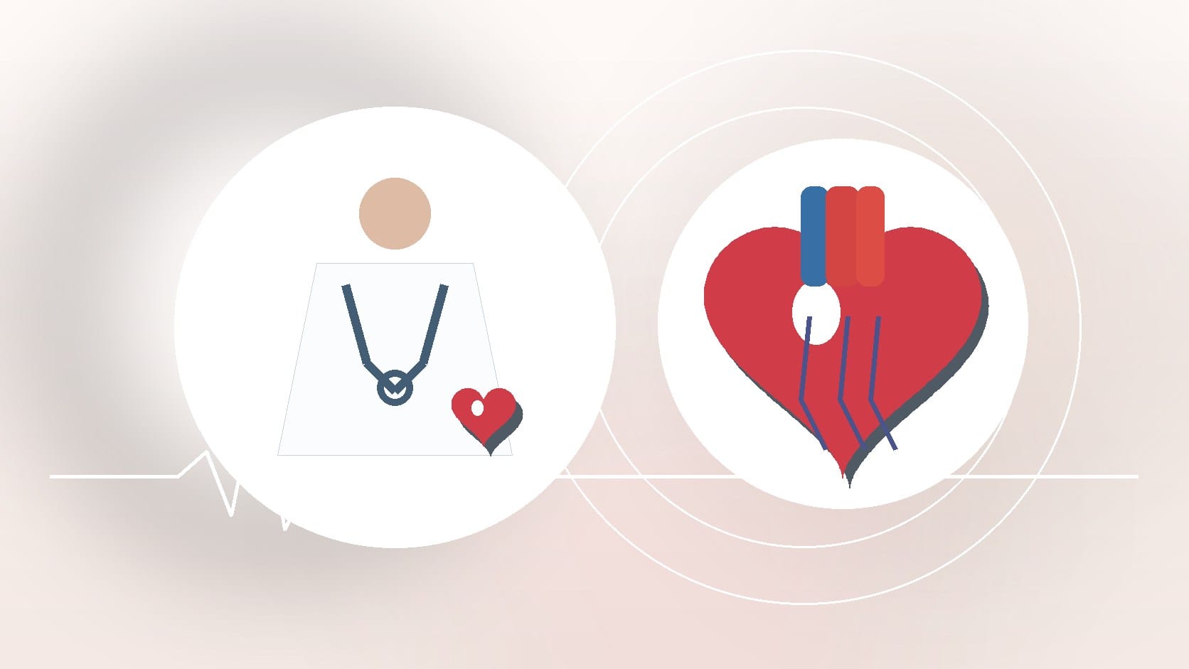 How Long Does a Cardiac MRI Take?