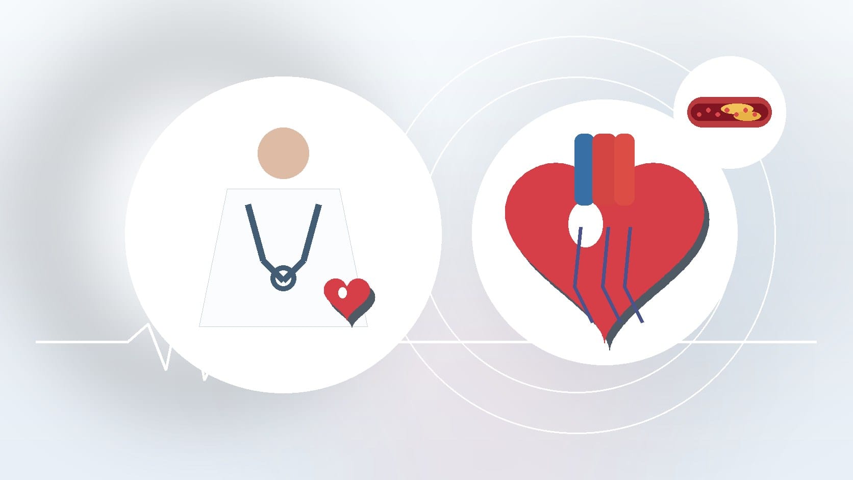 How Many Types Of Heart Diseases Are There?