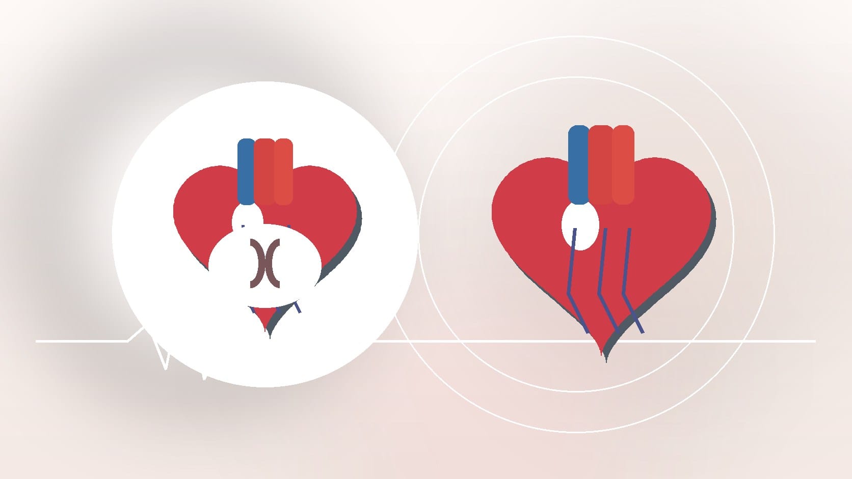 How Serious Is a Heart Murmur? What You Need to Know