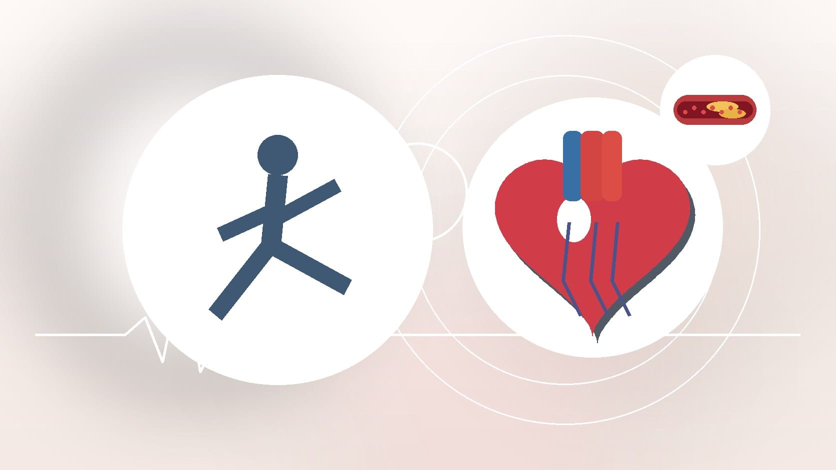 How to Prevent Cardiovascular Disease: Steps for a Healthier Heart