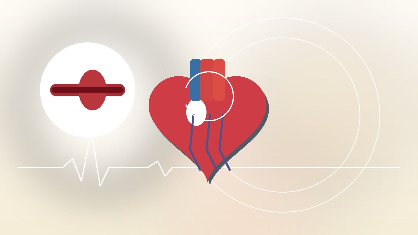 How to Stop an Aortic Aneurysm from Growing: Prevention & Monitoring Guide