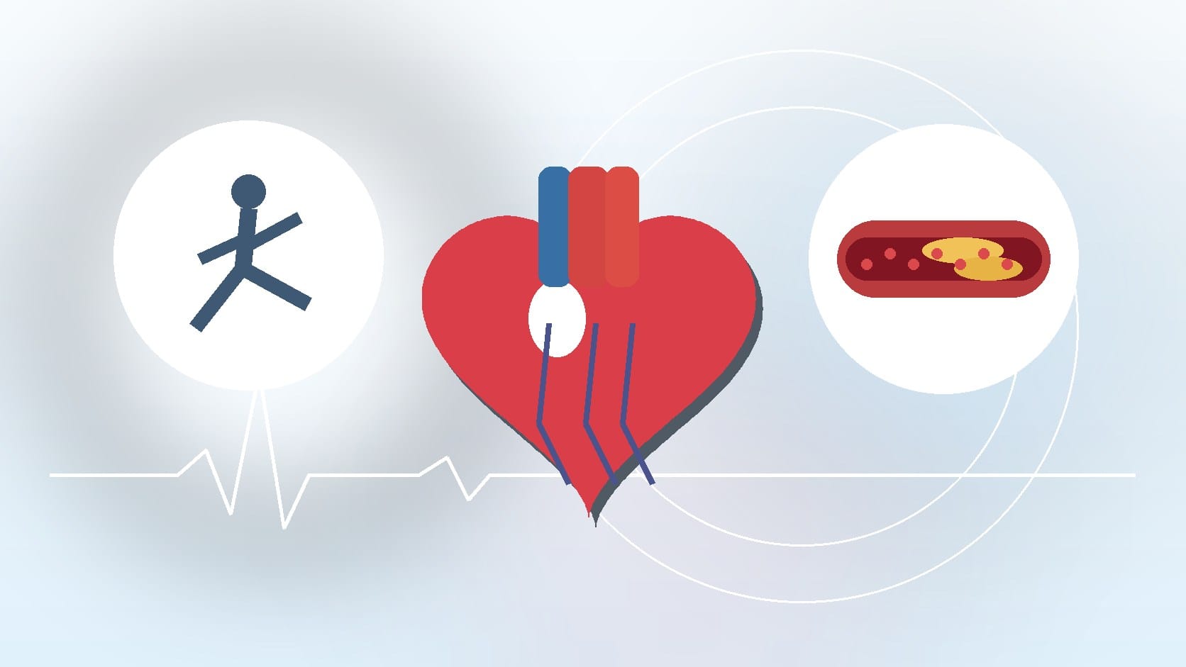 IS A LACK OF SLEEP AFFECTING YOUR CARDIOVASCULAR HEALTH?