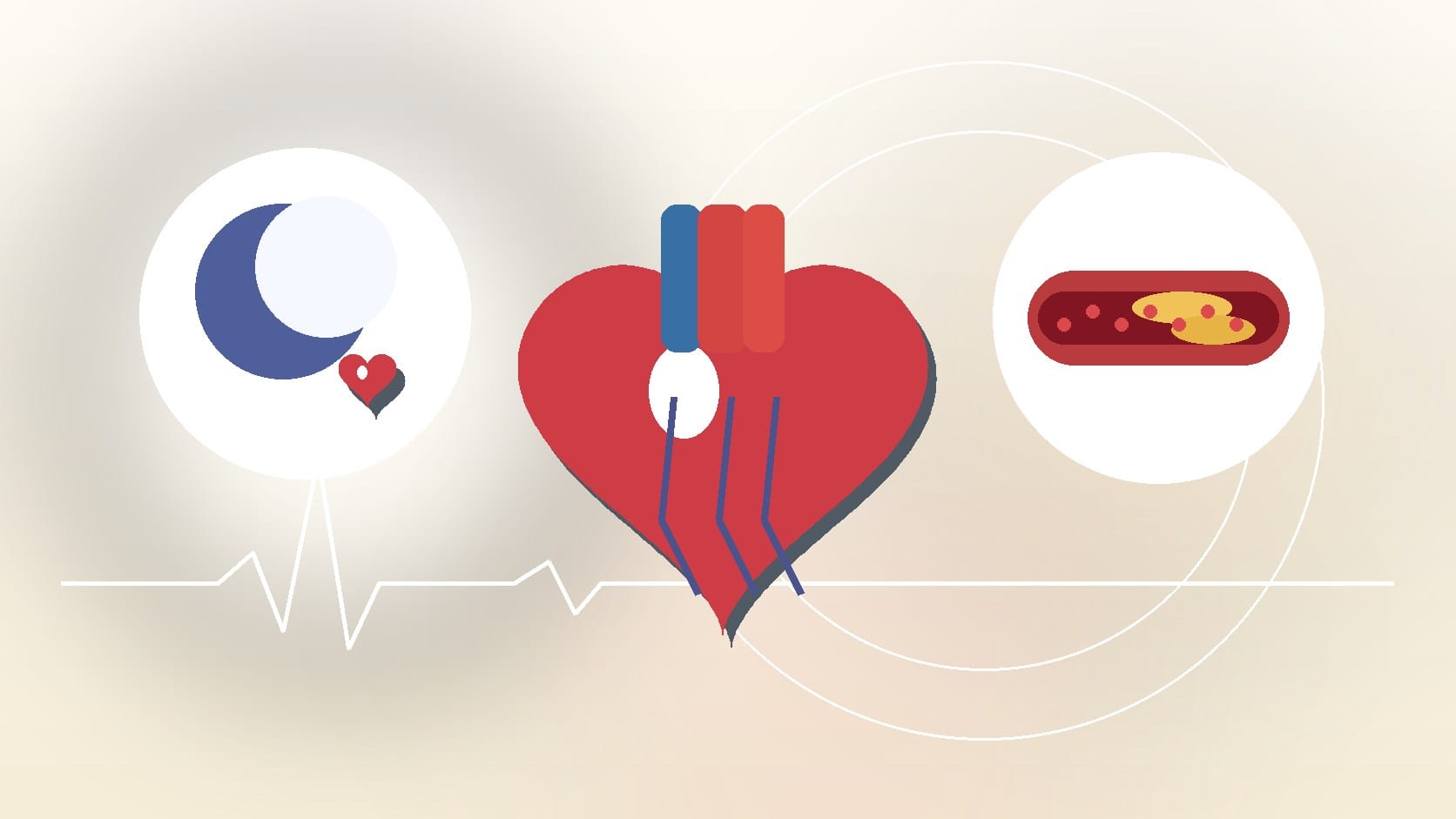 Is Sleep Apnea Related to Heart Disease?