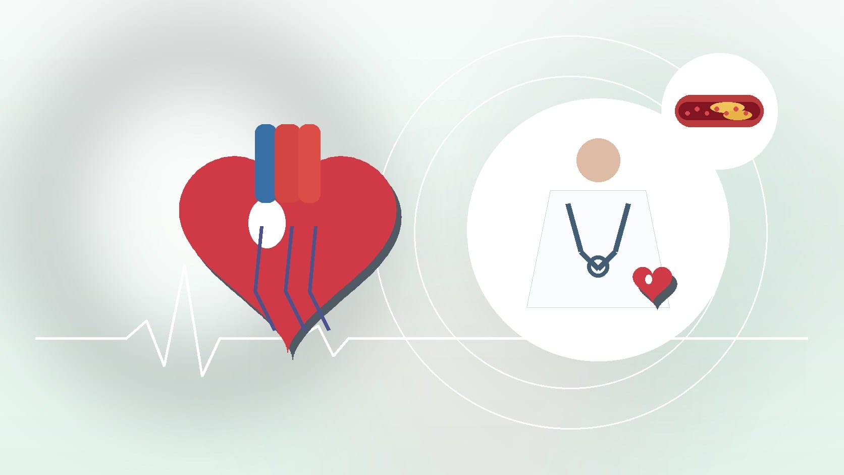 Key Characteristics of Congenital Heart Disease: Types, Symptoms, and Management