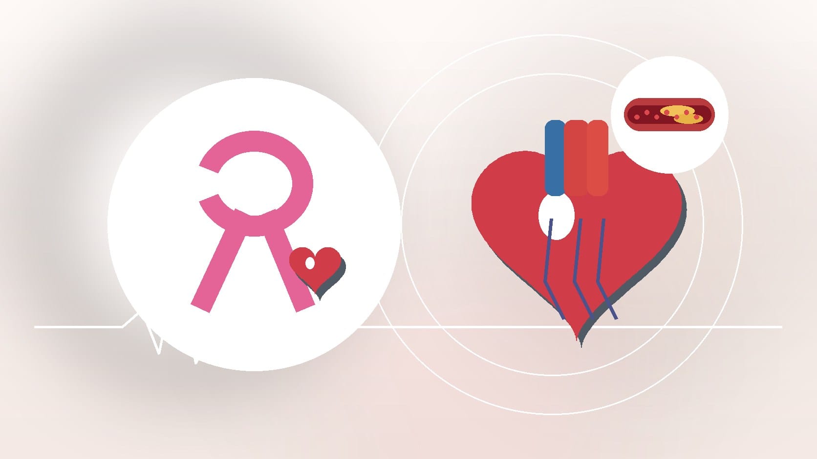 Movember: Prostate Cancer and Heart Disease