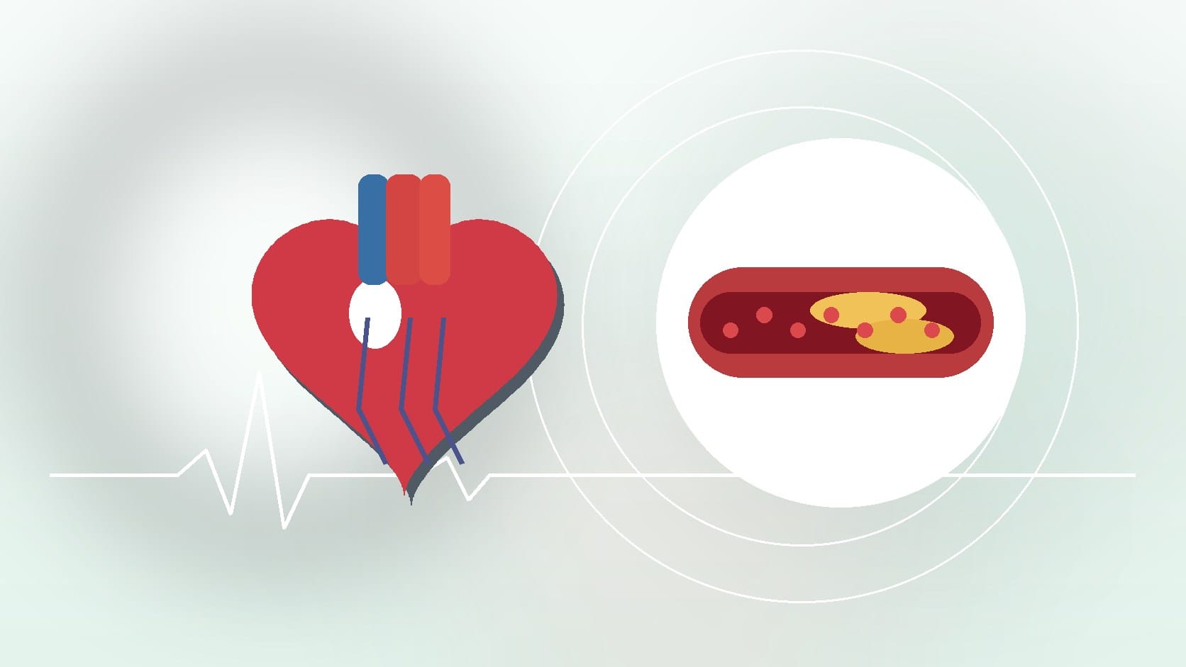 Recovering After Your Heart Attack: Changes and Adjustments to Make