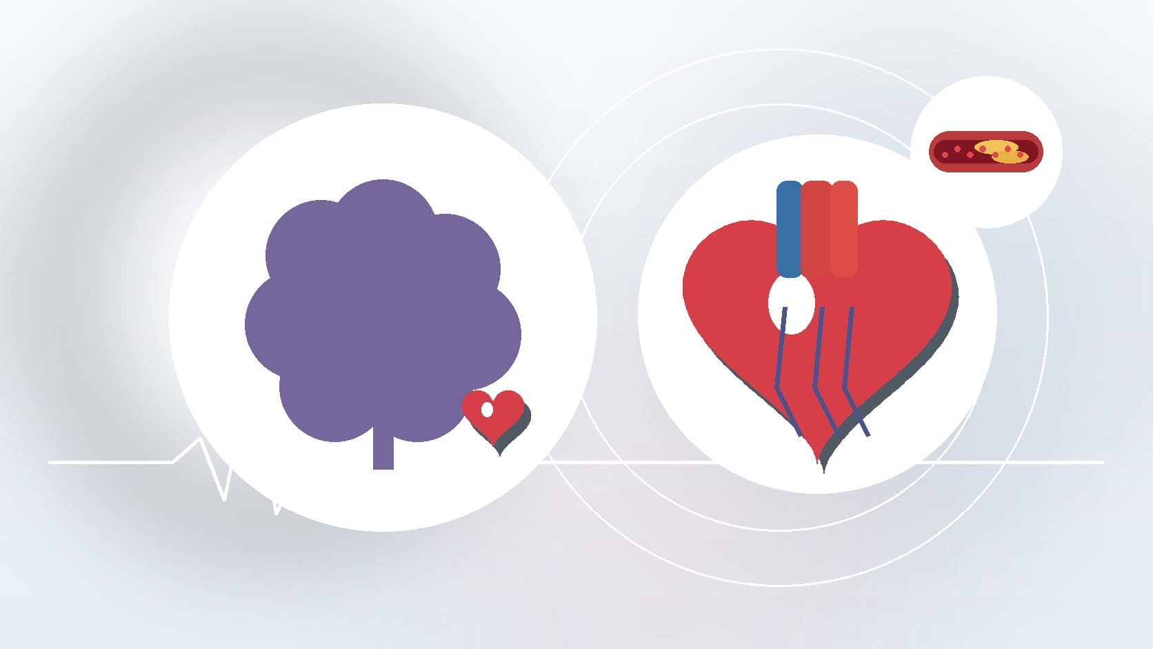 Stroke vs Heart Attack: Understanding the Critical Differences