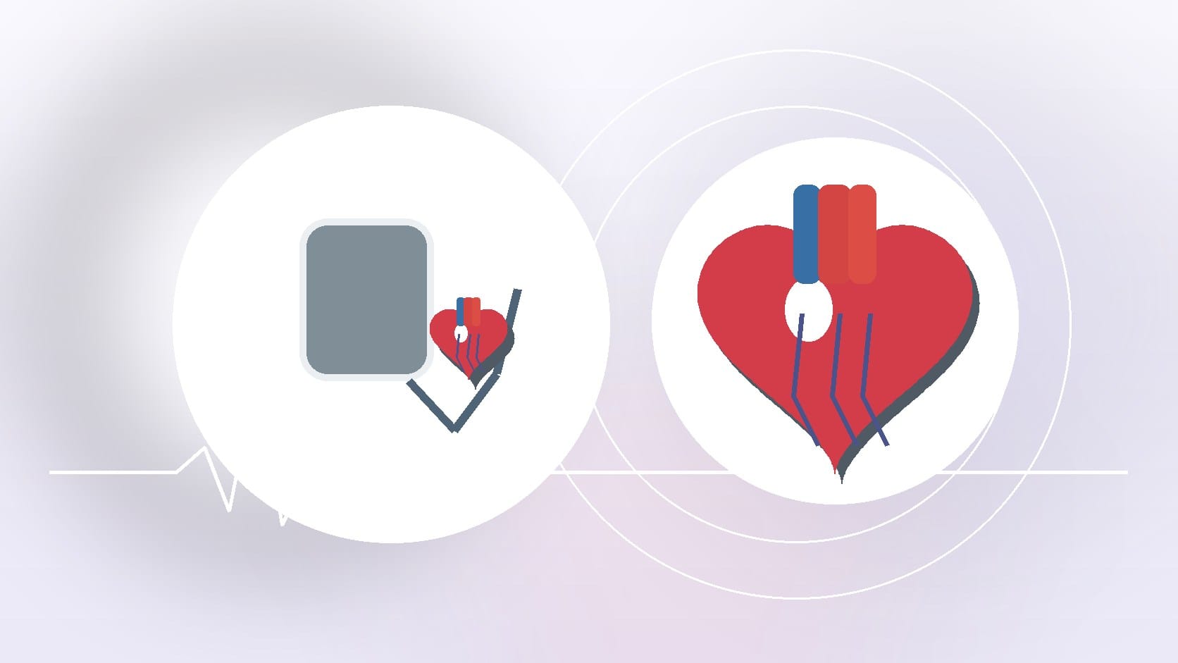 The World’s Smallest Pacemaker is Changing Lives