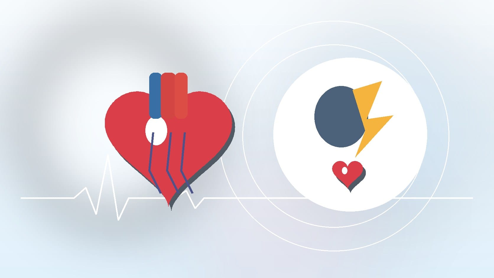 What Does a Stress Test Reveal About Your Heart?