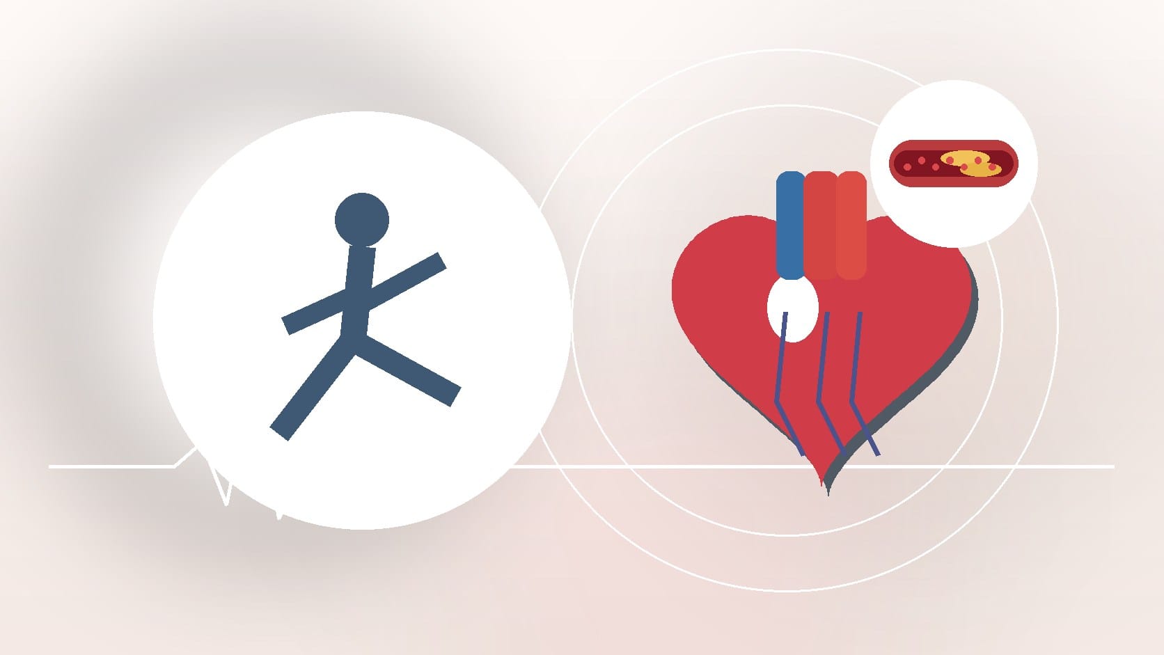 What Happens During an Electrophysiology Study Procedure? By Cardiovascular Group: Understanding the Process and Purpose