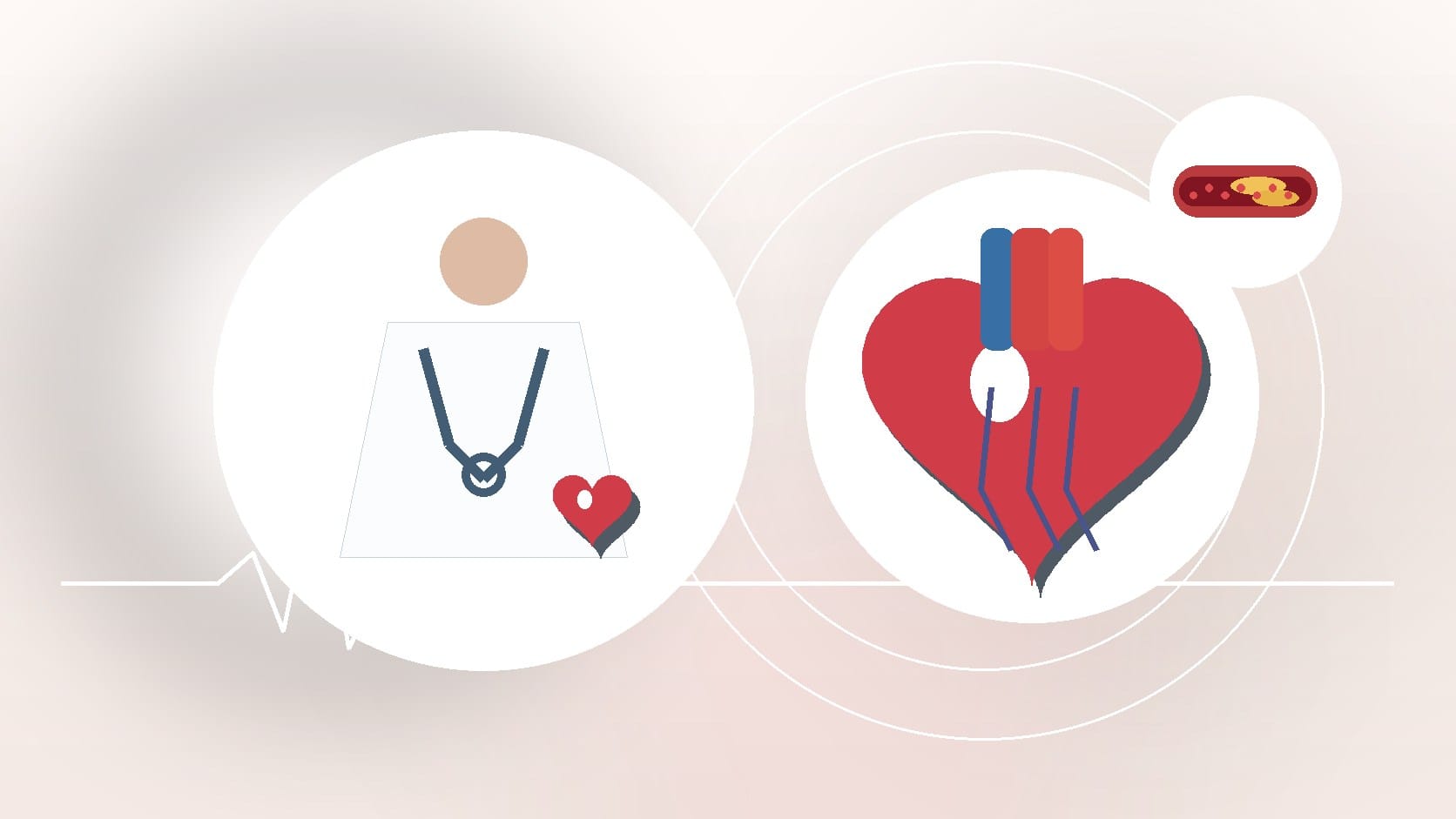 What Is Congenital Heart Disease? Causes and Types