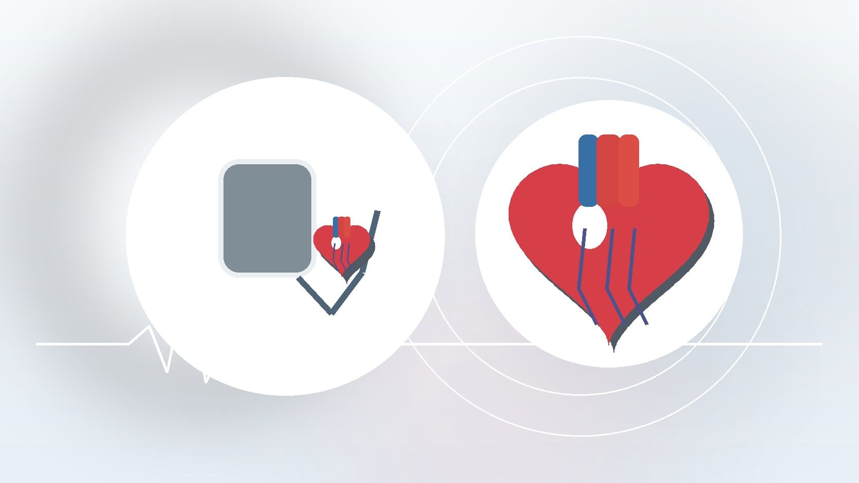 What is Heart Rate Variability?