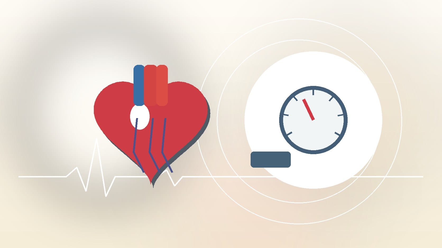 What is hypertension?