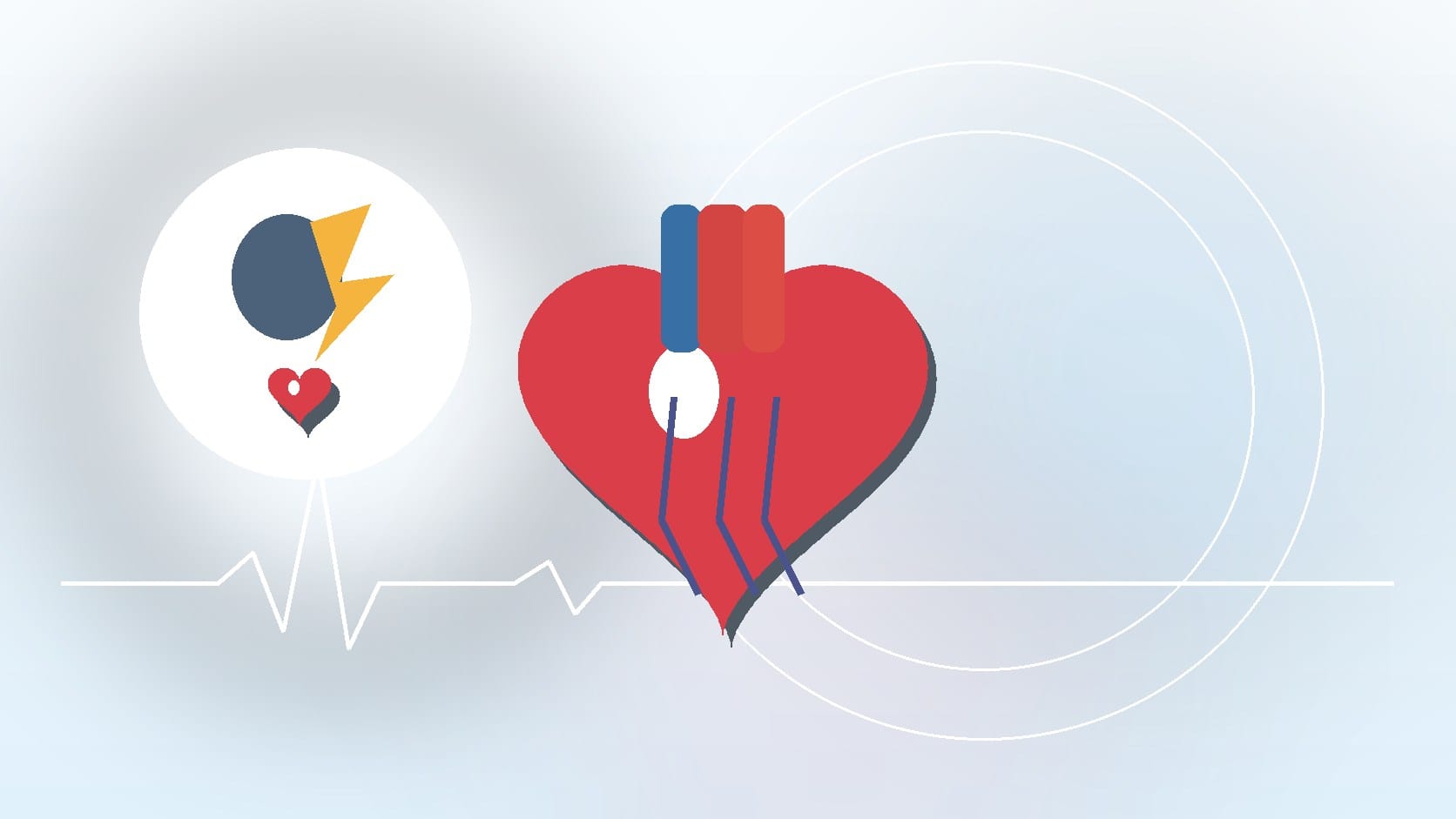 What to Expect From a Stress Test: Before, During, and After