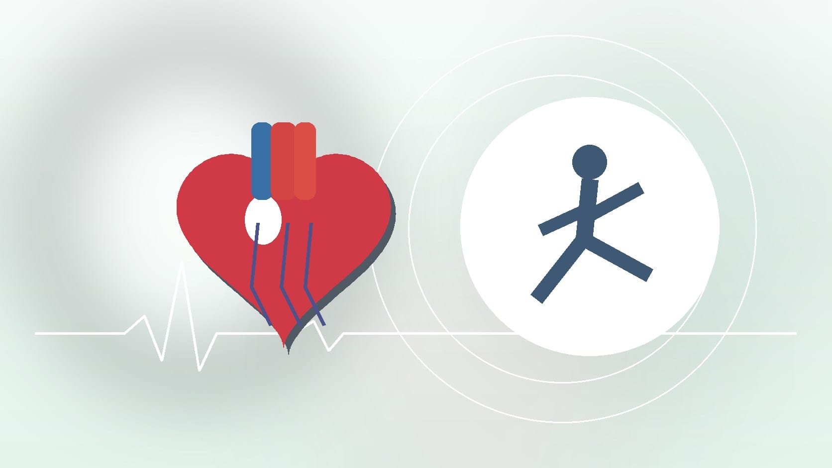 When Should You Get an Electrocardiogram? Key Signs to Watch For