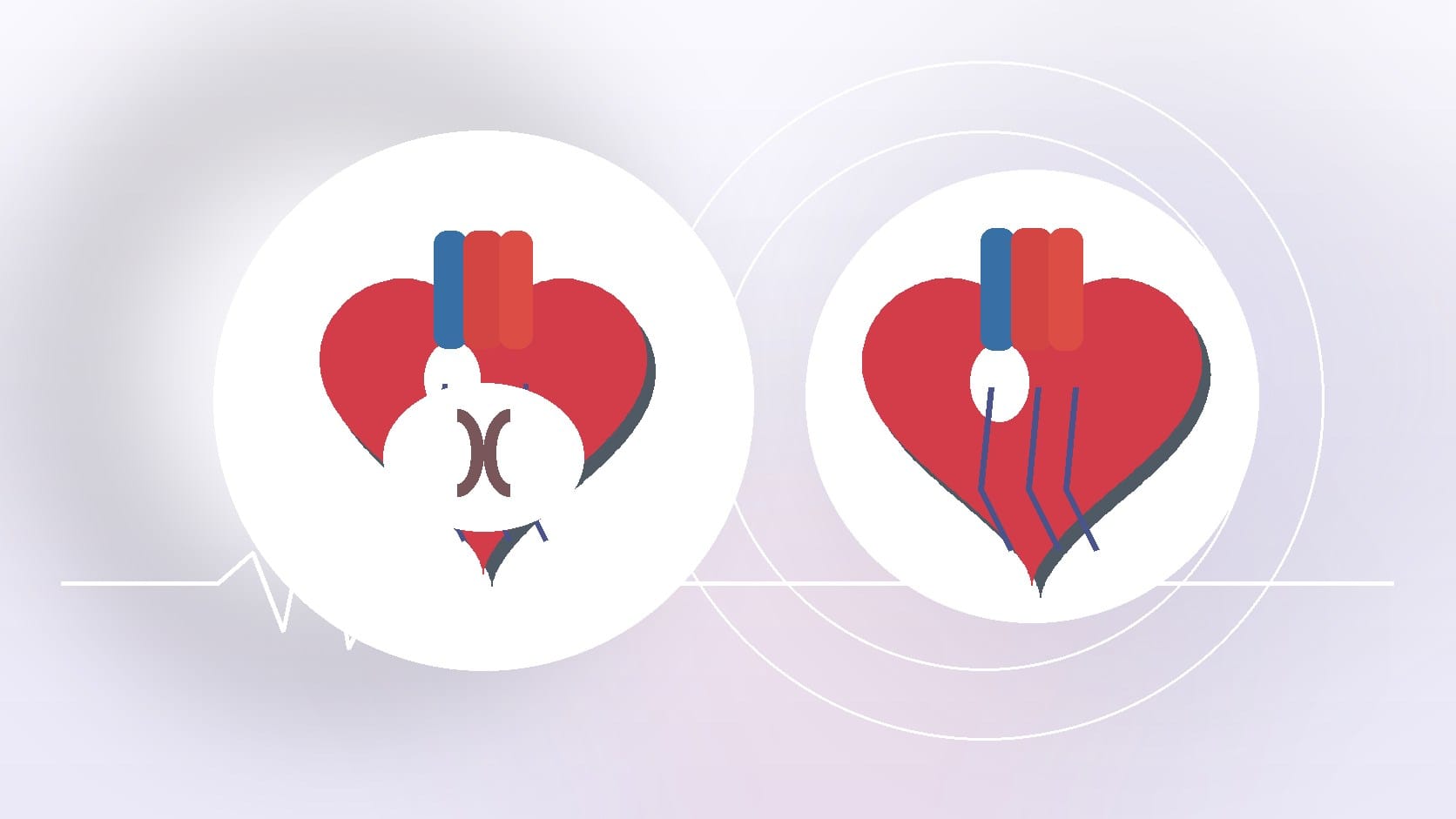 CVG Insights: Heart Murmur FAQs